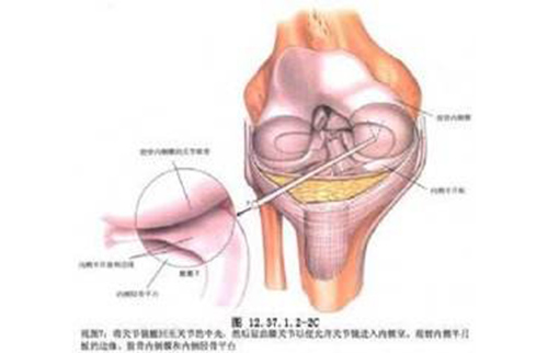 運(yùn)動(dòng)醫(yī)學(xué)（關(guān)節(jié)鏡）?？? title=